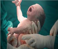 مصر الأولى عالميًا في الولادة القيصرية بنسبة 62%| فيديو
