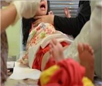  حبس طبيب أمراض نساء لإجراءه عملية ختان لطفلة بقنا