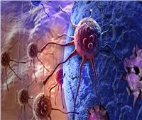 عالم روسي يوضح فاعلية تأثير العلاج الكيميائي ضد الخلايا السرطانية