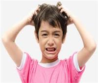 وصفات طبيعية لعلاج قشرة الرأس عند الأطفال