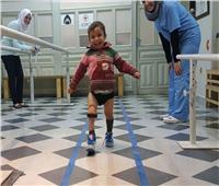 الفارق 5 سنوات.. صورتان لطفل سوري بـ«قدم واحدة» تخطف القلوب