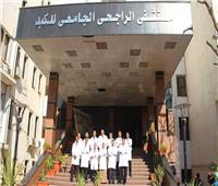نجاح 3 عمليات زرع كبد بمستشفى الراجحي الجامعي بأسيوط 