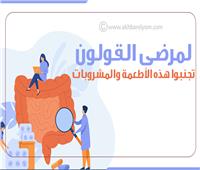 إنفوجراف | لمرضى القولون.. تجنبوا هذه الأطعمة والمشروبات