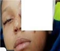 والدة تلميذ المنوفية المصاب: مدير المدرسة ومعلمة تسببا في «عاهة مستديمة» لابني