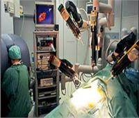 أستاذ جراحة: سعر الروبوت الطبي الواحد يتجاوز 36 مليون جنيه| فيديو