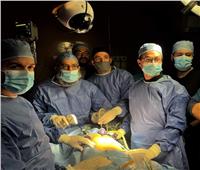 إجراء جراحة دقيقة لمريض بـ «متلازمة زينر» بطب بني سويف