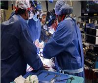 العملية الأولى من نوعها.. أمريكيون ينجحون بزراعة قلب خنزير لإنسان