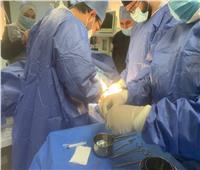 إجراء جراحة لتركيب وصلة شريانية وريدية لمرضى الغسيل الكلوي للمرة الأولى