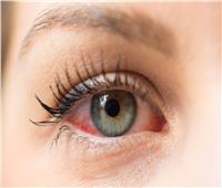 علامات في الأذنين والرأس والعينين تدل على الإصابة بعدوى أوميكرون