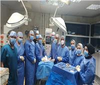 فريق طبي بجامعة الأزهر ينجح في إجراء عملية جراحية لتوأم غير مكتمل النمو 