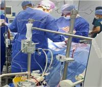 إجراء جراحات القلب المفتوح في مستشفى الزقازيق العام