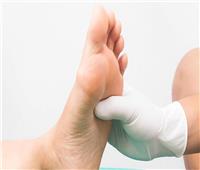 «داء السكري من النوع 2».. أعراض تظهر في القدم تؤدي إلى مضاعفات خطيرة 