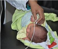 تفاصيل فحص 2.8 مليون طفل بمبادرة الكشف عن ضعاف السمع وحديثي الولادة | فيديو