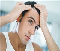 تساقط الشعر عند الرجال .. نصائح وعلاجات لجعل الشعر ينمو بشكل أسرع