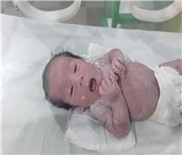 استقبال حالة نادرة لطفل شمعي بحضانة مستشفى عزبة البرج بدمياط