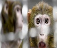 متحدث الصحة يوضح أسباب الإصابة والإجراءات الوقائية من جدري القرود