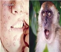بعد انتشاره في بعض الدول.. ما هو مرض جدري القرود؟| فيديو