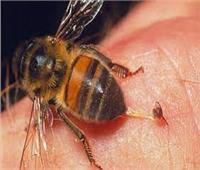 هل لدغة النحلة تسبب الوفاة؟.. أستاذ علاج سموم وإدمان يجيب | فيديو