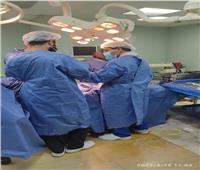إجراء 6 عمليات جراحية بمستشفى رشيد ضمن مبادرة القضاء على قوائم الانتظار 