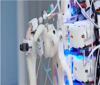 تكنولوجيا طبية جديدة ..أوتار روبوتية تساهم في حل المشكلات الصحية