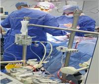 إجراء جراحة قلب مفتوح لإنقاذ حياة مريضة بمستشفى الزقازيق بالشرقية