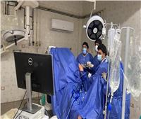 إجراء 3 عمليات متقدمة لجراحة العظام بمستشفى حمدي الطباخ بالبحيرة 