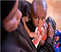 الرئيس الصومالي يعلن رسميا دخول بلاده في مجاعة