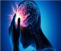 3 علامات حاسمة تؤكد الإصابة بسكتة دماغية