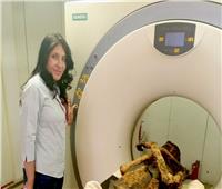 أستاذ علم الأشعة تكذب ادعاء فريق بحثي بولندي باكتشاف مومياء مصرية لسيدة حامل