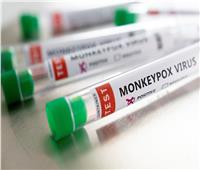 إيران تسجل أول حالة إصابة بفيروس جدري القرود