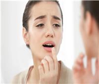 علامات تظهر على الفم تدل على الإصابة بمشكلة صحية.. تعرف عليها
