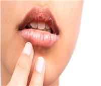 تعرف على أعراض وأسباب وعلاج جفاف الفم