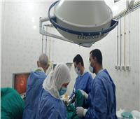  إجراء 11 عملية جراحية متنوعة بمستشفى الدكتور حمدى الطباخ بالبحيرة