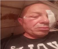 إصابة قائد قطار إكسبريس  «شربين- طنطا» بعد قذفه بالحجارة