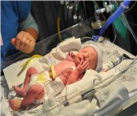 الولادة المبكرة ...سبب رئيسى لزيادة وفيات  الأطفال 