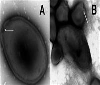 خبراء: «فيروسات الجليد» المذاب تؤدي إلى أوبئة خطيرة