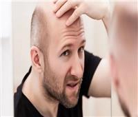 مشروبات تزيد من خطر تساقط الشعر لدى الرجال