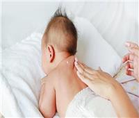 للأمهات.. طرق لحماية طفلك الرضيع من لدغات البعوض