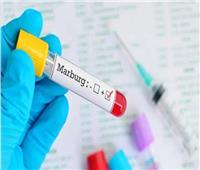 إسبانيا ترصد أول إصابة محتملة بفيروس ماربورج لديها