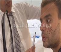 رامي صبري يُجمل وجهه بـ«عملية جراحية»| صور