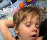 صور| «إيسلا».. طفلة في عمر الثلاث سنوات عانت من سرطان العين النادر  