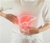 الإمساكية الصحية| أطعمة جيب على مرضى الكبد تناولها في رمضان 