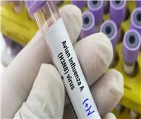 الصحة العالمية: الصين تسجل أول حالة وفاة بفيروس إنفلونزا الطيور «H3N8»