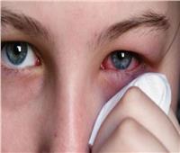 للعواصف الترابية.. نصائح صحية لتجنب أمراض العيون
