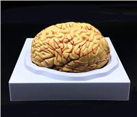 علماء يزرعون حاسوبًا في دماغ قرد