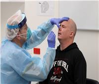 باحثون أمريكيون: الإصابة بكورونا قد يحدث تغييرات في جهاز المناعة