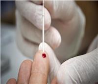 علاج جديد يقلّص خطر تقدّم نوع نادر من سرطان الدم بنسبة 74%