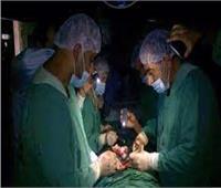 إجراء جراحة على كشاف موبايل في 2012 بسبب انقطاع الكهرباء.. فيديو