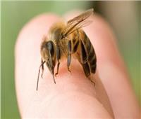 أضرار لسعات النحل وخطوات علاجها