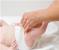 «سنة أولى أمومة».. 3 أنواع لالتهابات الحفاض وطرق الوقاية منها